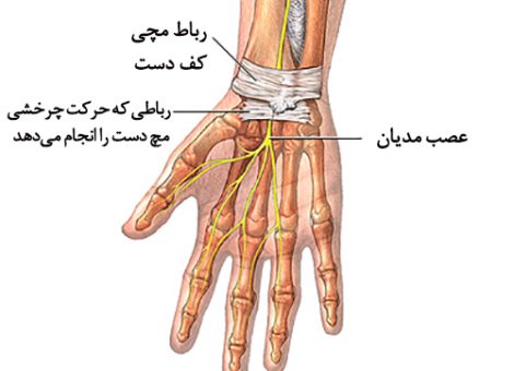 سندرم تونل کارپال